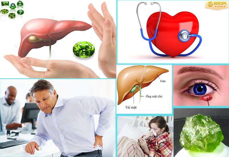 đá peridot có tác dụng chữa nhiều loại bệnh