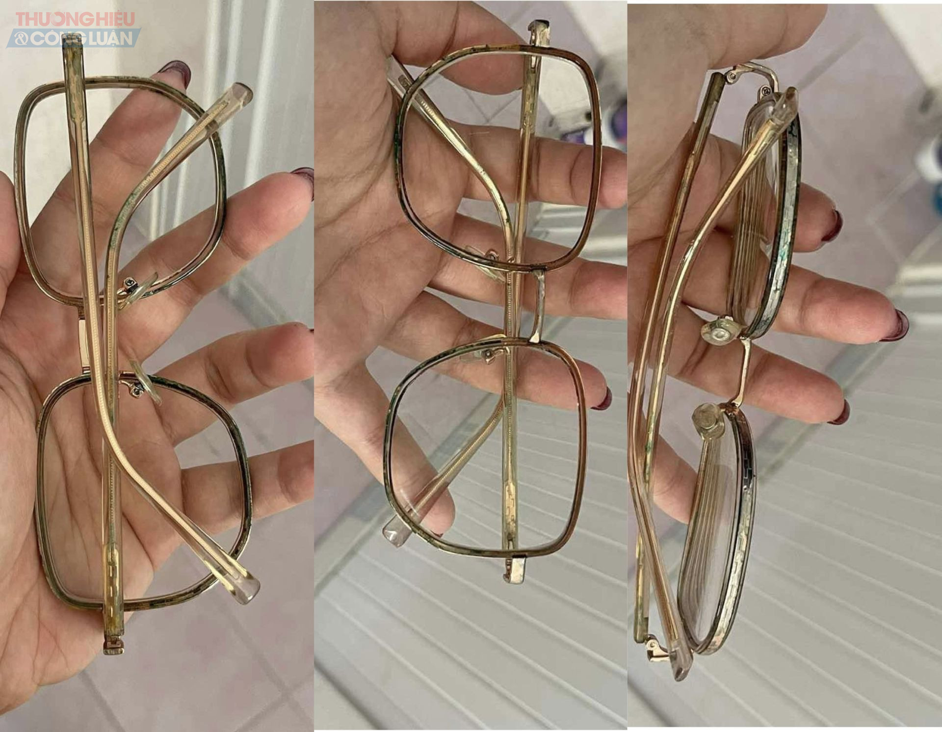 Kính mắt Anna chị N. sử dụng có dấu hiệu tróc vỏ, đổi màu sau khi sử dụng