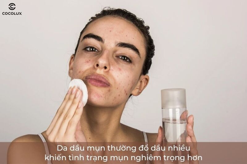 Đặc điểm của da dầu mụn