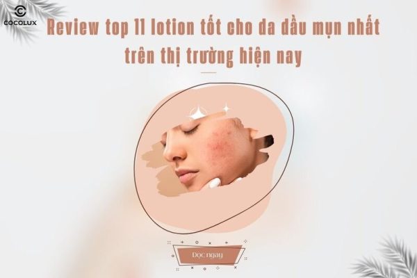 Review top 11 lotion tốt cho da dầu mụn nhất trên thị trường hiện nay