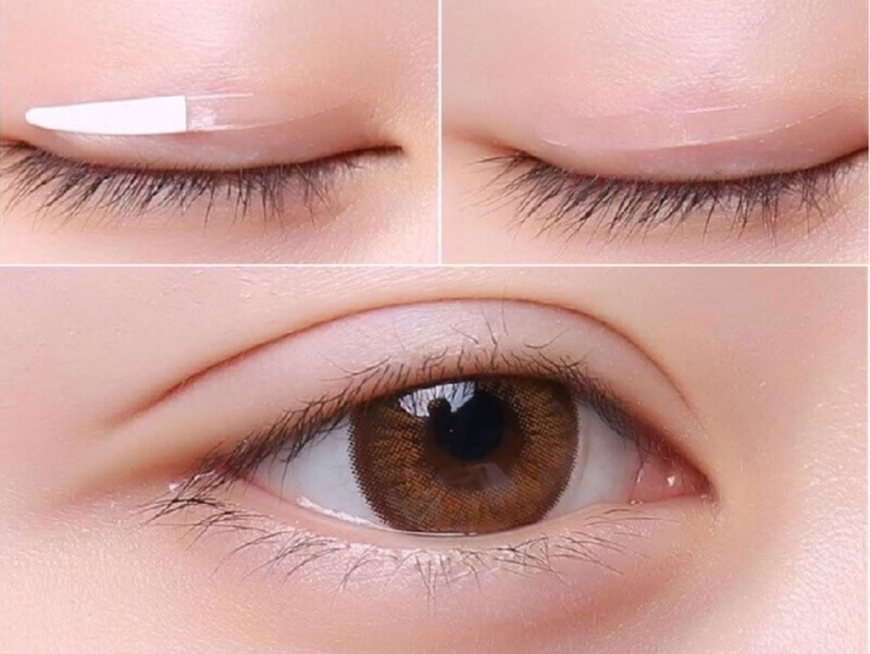 Cách khắc phục mắt to mắt nhỏ bạn đã biết chưa? 1