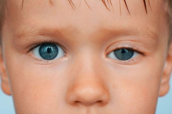 Cách khắc phục mắt to mắt nhỏ bạn đã biết chưa?