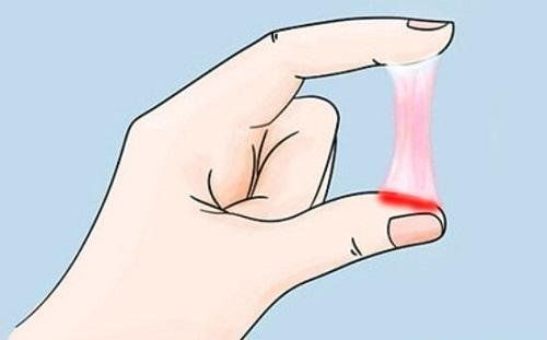 Khi thấy khí hư bất thường nên được thăm khám và điều trị kịp thời