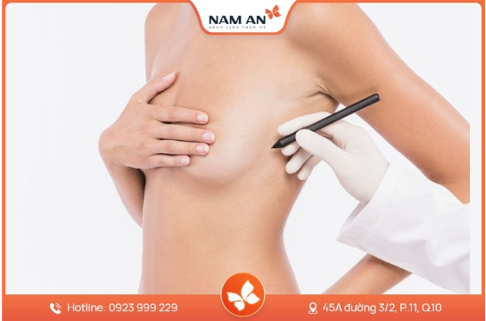 Nâng Ngực Bằng Mỡ Tự Thân Có Bền Không Giữ Được Lâu Không (3)