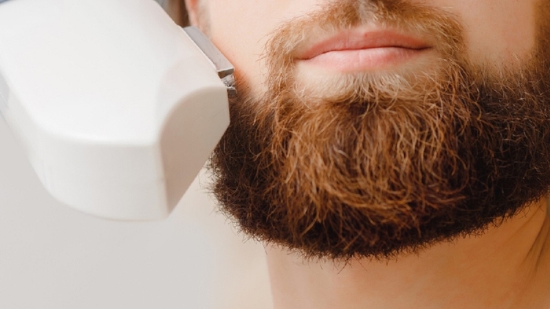 Nam giới có nên triệt râu không? Các phương pháp triệt râu vĩnh viễn
