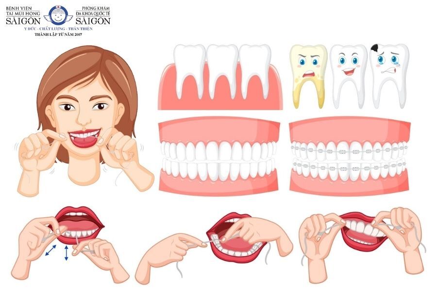 Nên dùng chỉ nha khoa để phòng ngừa đau xương hàm