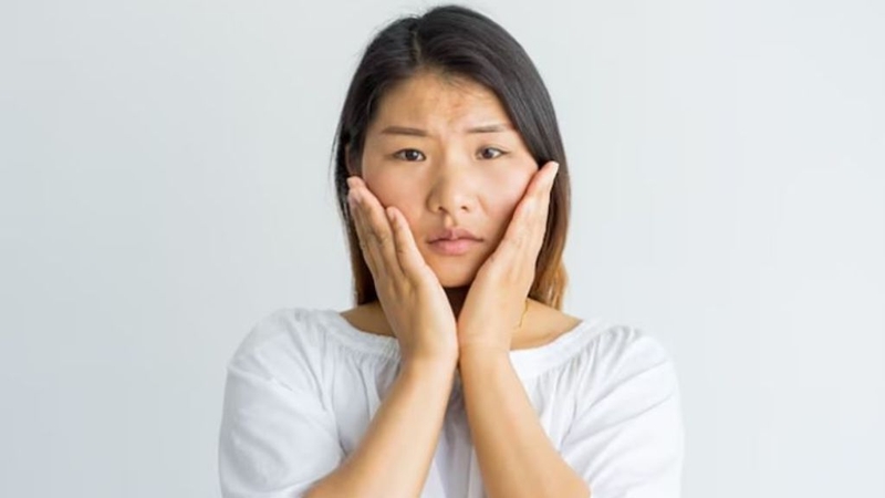 Vì sao người gầy nhưng mặt béo? Một số cách làm giảm béo mặt một cách tự nhiên