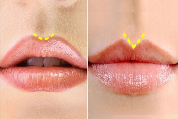 'Mỏng môi hay hớt', liệu đúng hay sai, vận vào những người thế nào?