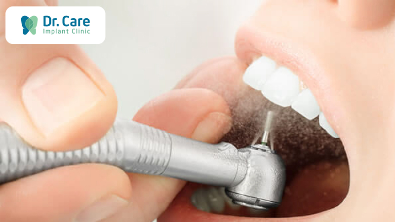 Biến chứng bọc răng sứ sai kỹ thuật 