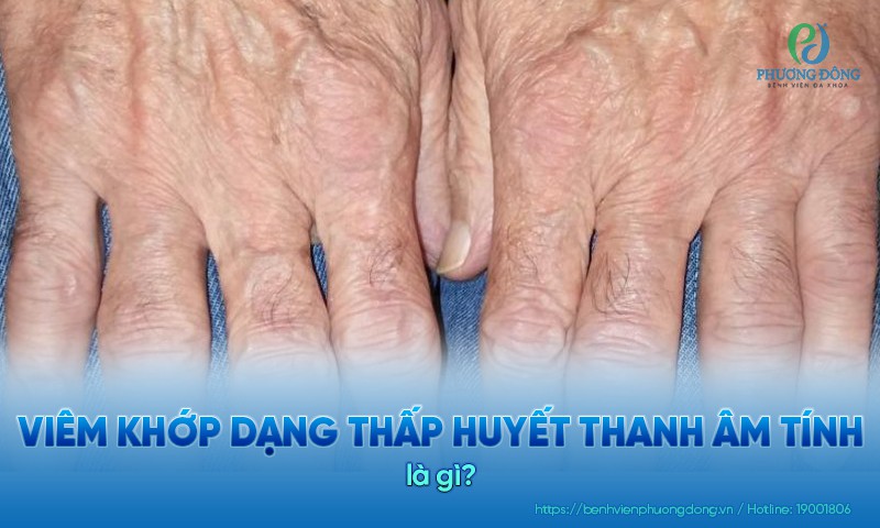 Viêm khớp dạng thấp huyết thanh âm tính: Triệu chứng, nguyên nhân và điều trị
